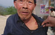 七旬老汉买新马被咬伤数次